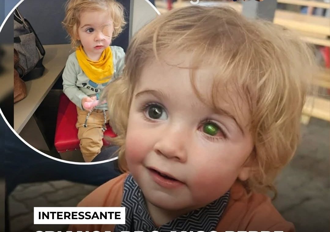 O herpes labial, causado pelo vírus quando transmitido por beijo no olho ou rosto por alguém com lesão ativa herpes simplex tipo 1 (HSV-1), representa um risco grave para crianças pequenas